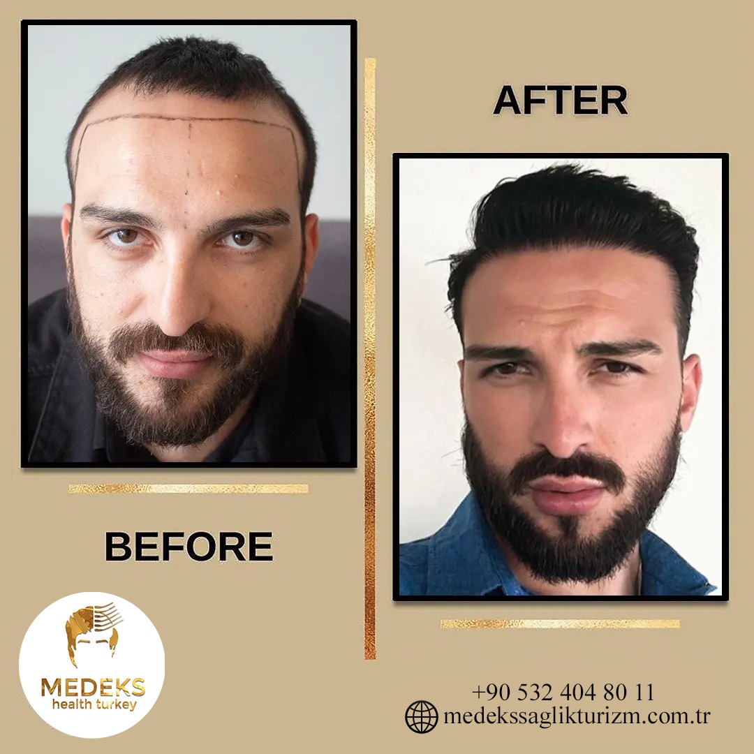 Before & After 1
