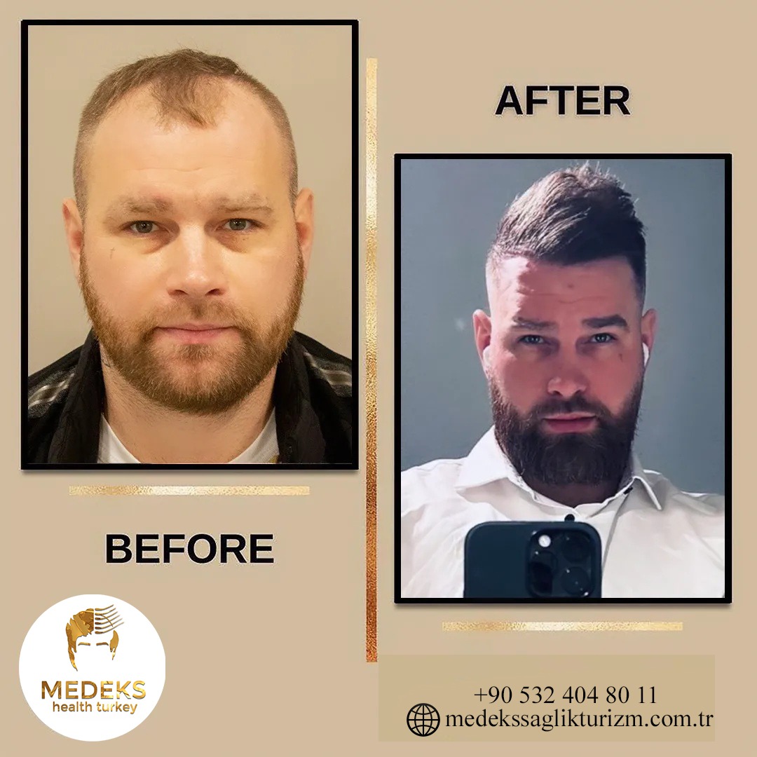 Before & After 2