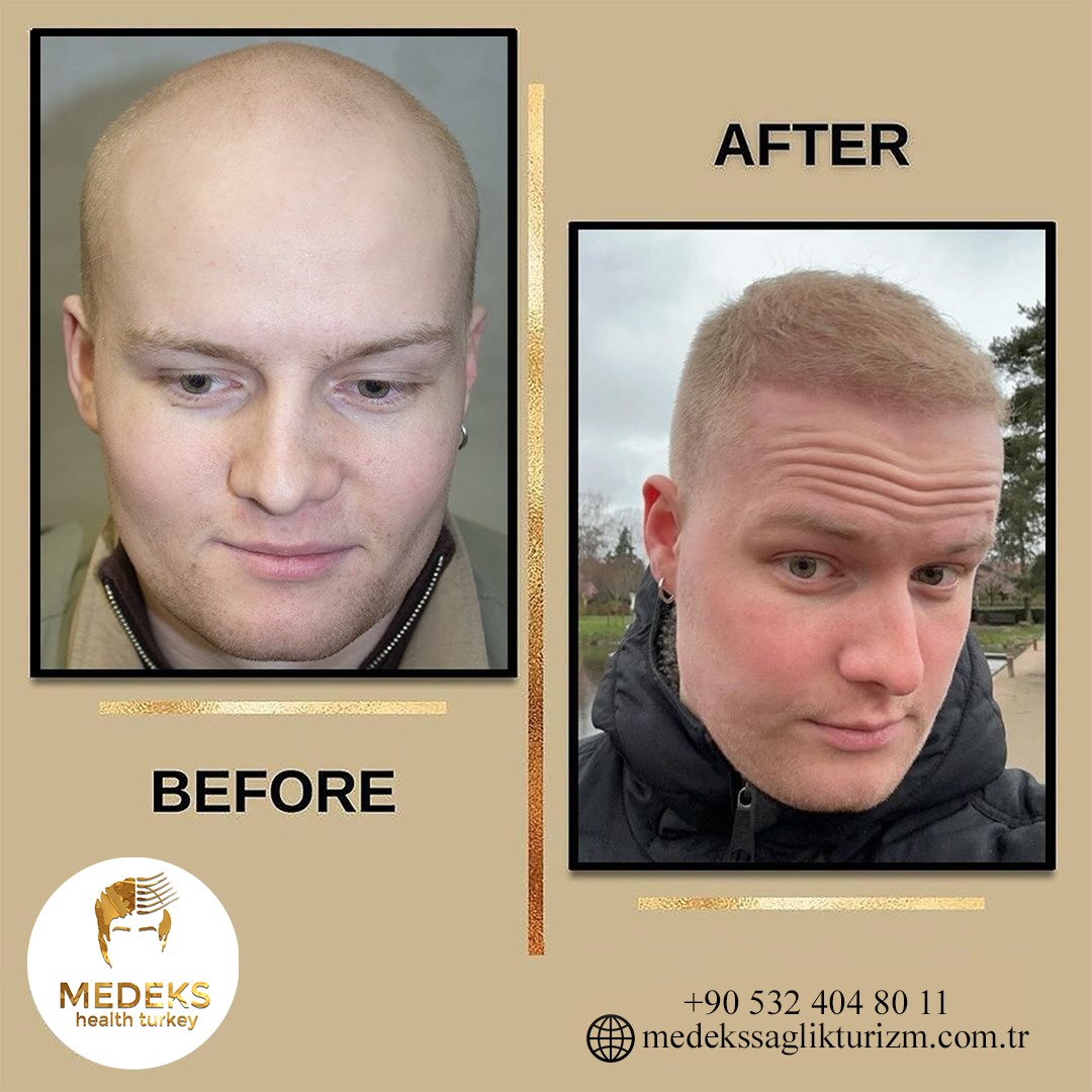 Before & After 3