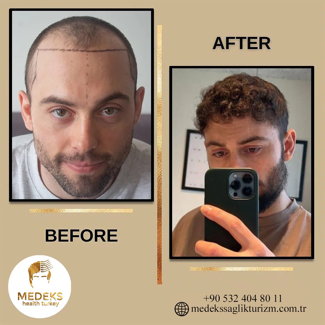 Before & After 5