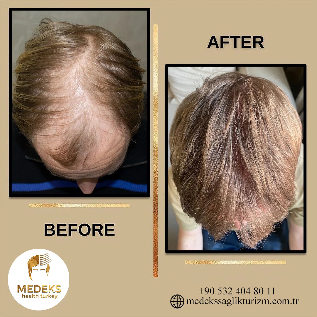 Before & After 6