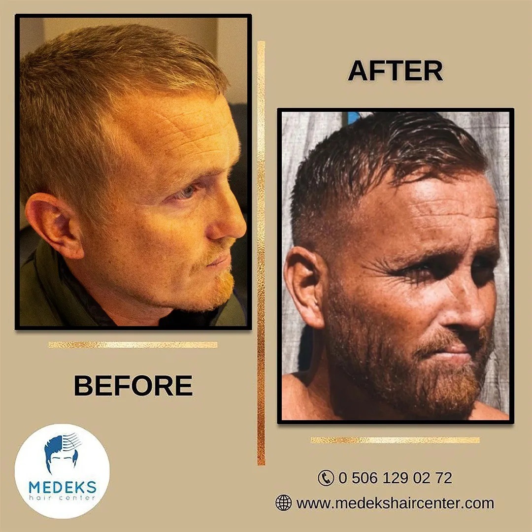 Before & After 7